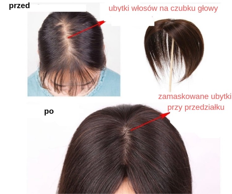ubytki włosów na czubku głowy.jpg